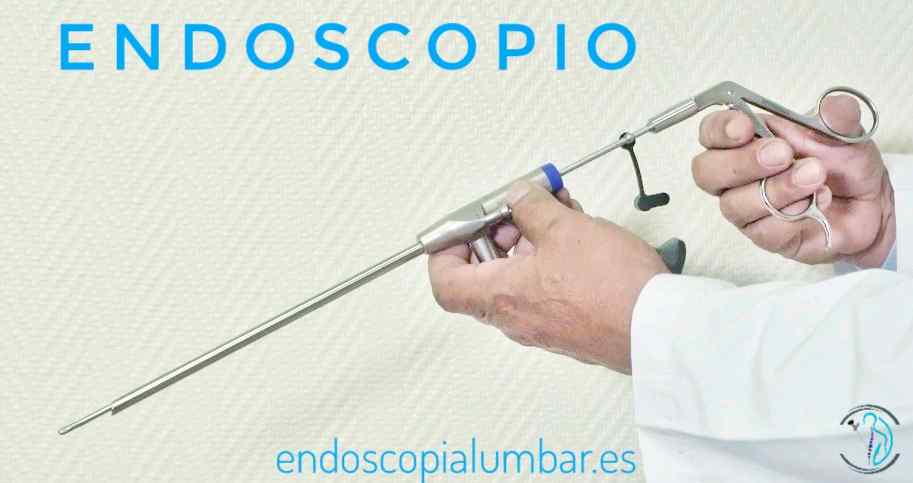 endoscopio